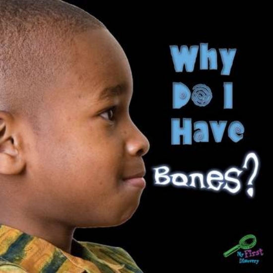 Picture of Why Do I Have Bones?
