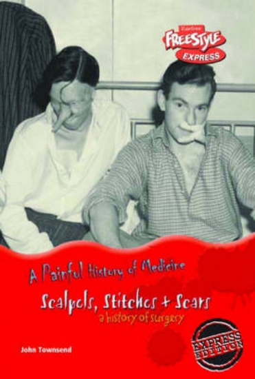 Picture of Freestyle Express: Painful History Medicine: Scalp