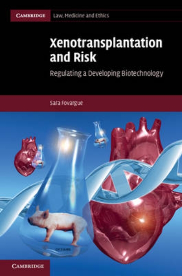 Picture of Xenotransplantation and Risk